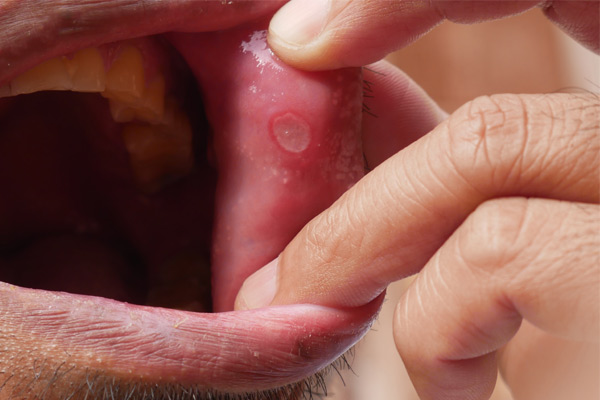 Mouth